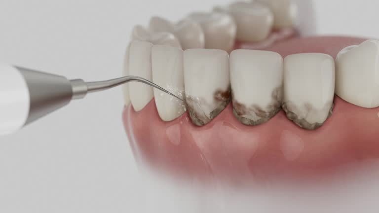 Reliable Dental Implants contractor in Bemidji, MN by Smile Center Dentistry